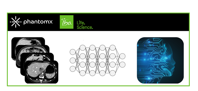 Iba Mini Phantom R IBA integrates Artificial Intelligence Quality Assurance into dosimetry ...